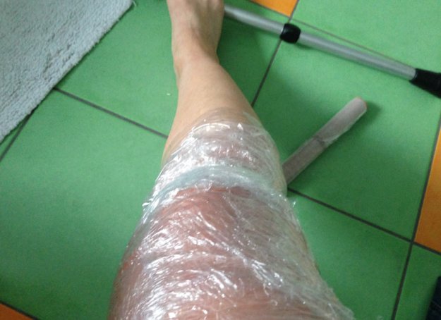 knie-in-frischhaltefolie.jpg